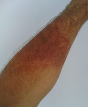 Mars Volta off-shoot Antemasque accused of throwing boiling water at fans during show