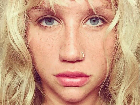 Dr. Luke claims Kesha owes him $1.3 million in royalties