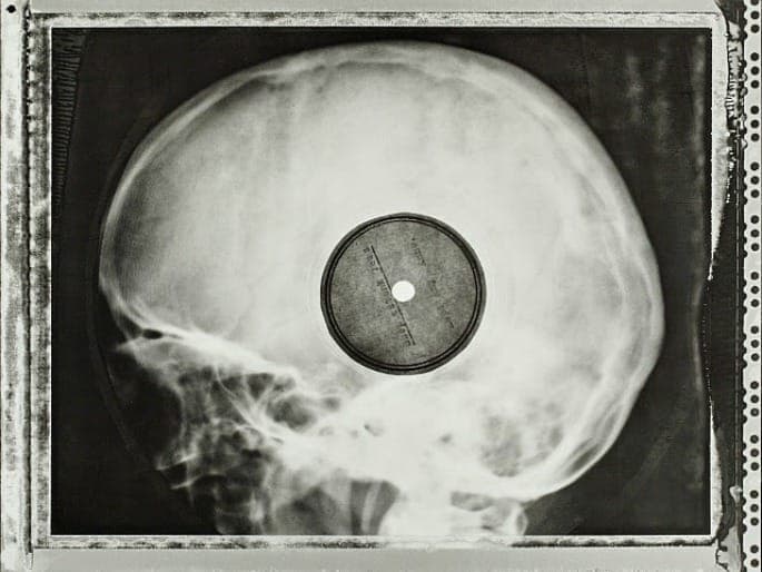 Check out these incredible images of Soviet-era bootleg records pressed on discarded X-rays