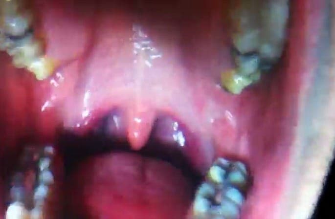 Watch the icky second video from Arca and Jesse Kanda’s TRAUMA project
