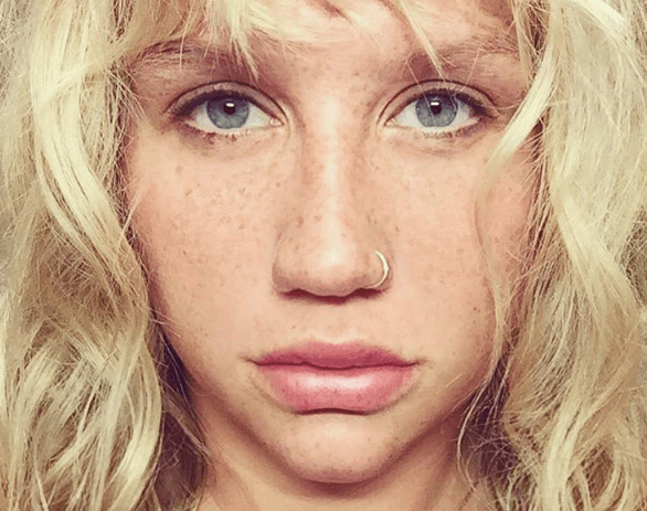 Kesha drops California lawsuit against Dr Luke: “I need to get my music out”